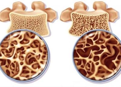 استخوان ها غیر از کلسیم به کدام ریزمغذی ها احتیاج دارند؟